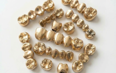 Dental Gold